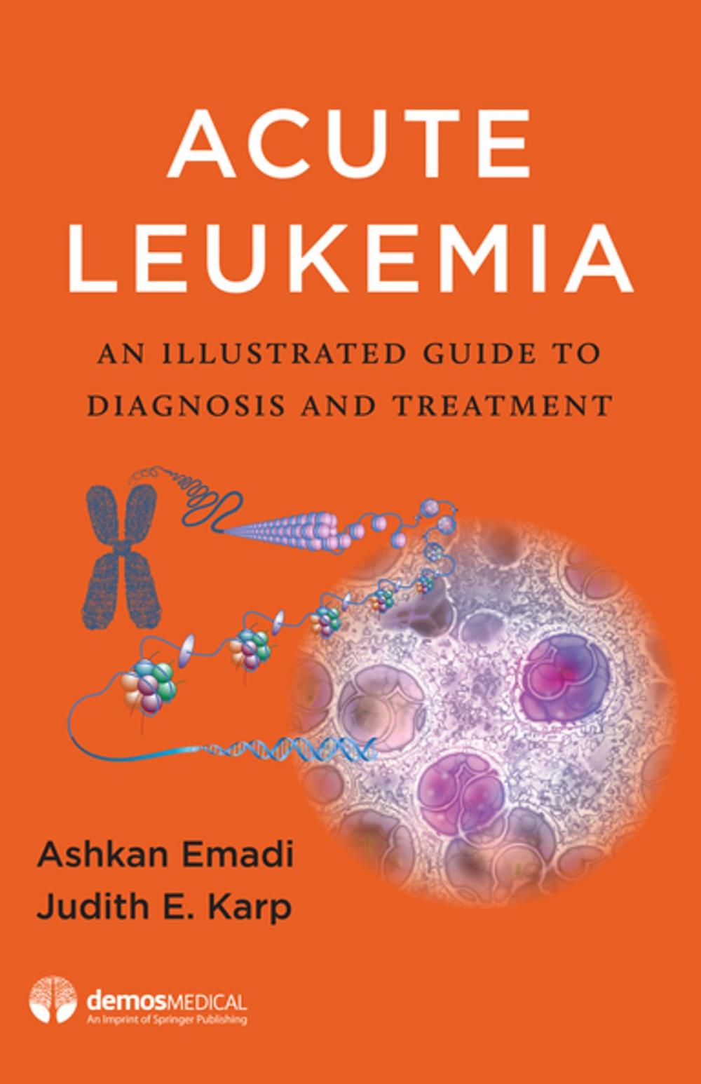 Big bigCover of Acute Leukemia