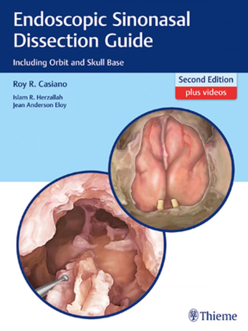 Big bigCover of Endoscopic Sinonasal Dissection Guide