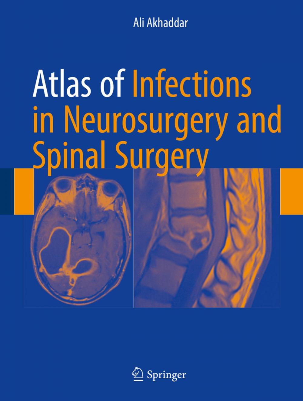 Big bigCover of Atlas of Infections in Neurosurgery and Spinal Surgery