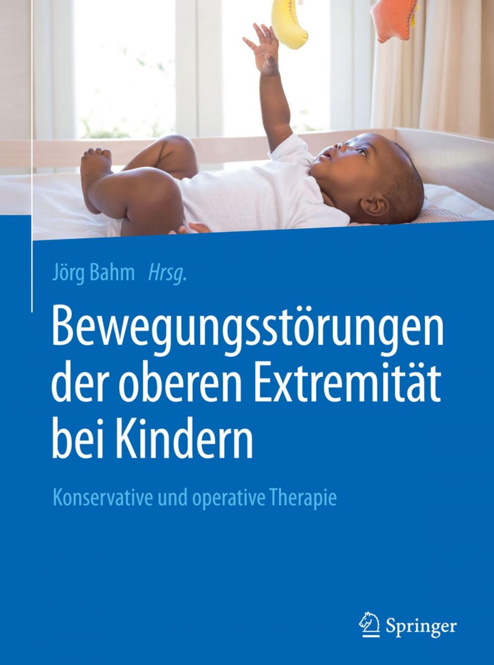 Big bigCover of Bewegungsstörungen der oberen Extremität bei Kindern