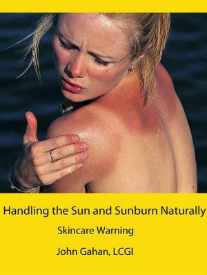 Cover of the book Handling the Sun and Sunburn Naturally: Skincare Warning by DeRose