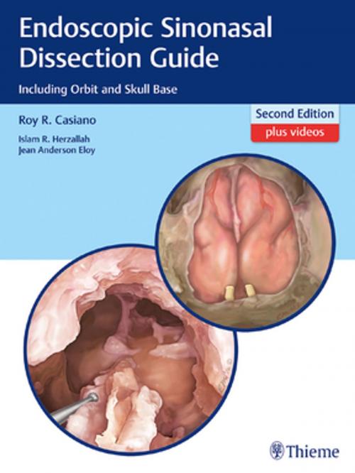 Cover of the book Endoscopic Sinonasal Dissection Guide by Roy R. Casiano, Islam Herzallah, Jean Eloy, Thieme