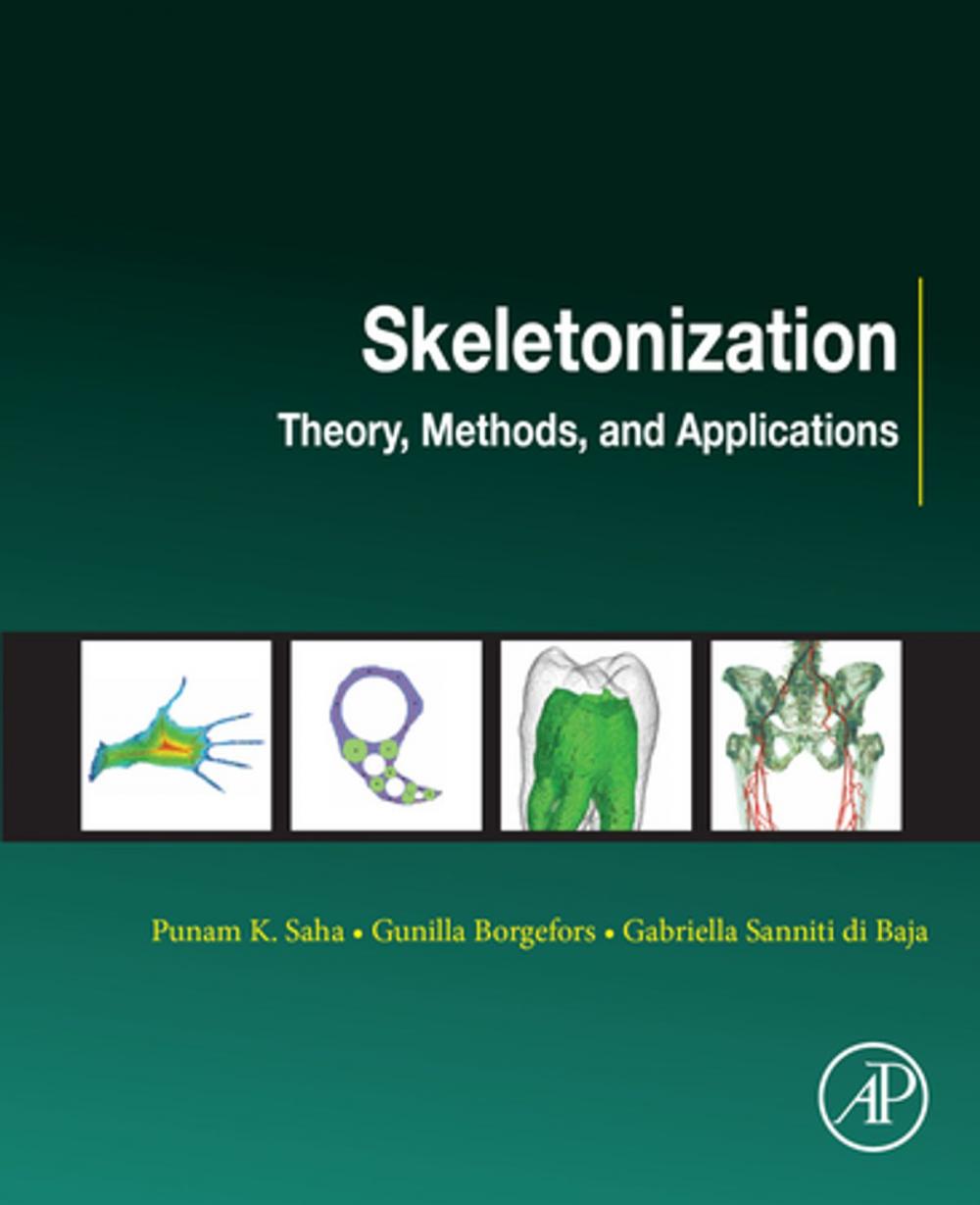 Big bigCover of Skeletonization