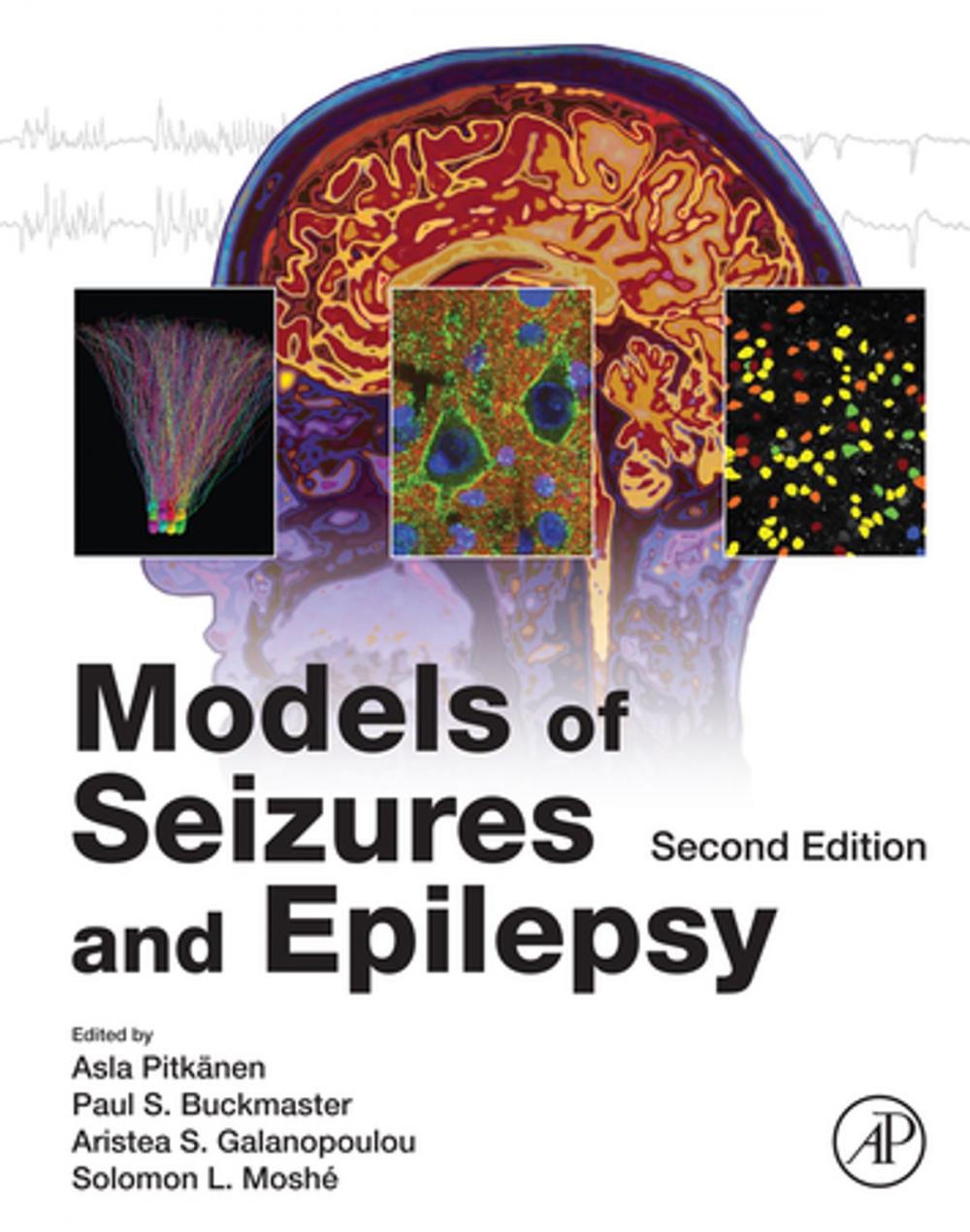 Big bigCover of Models of Seizures and Epilepsy