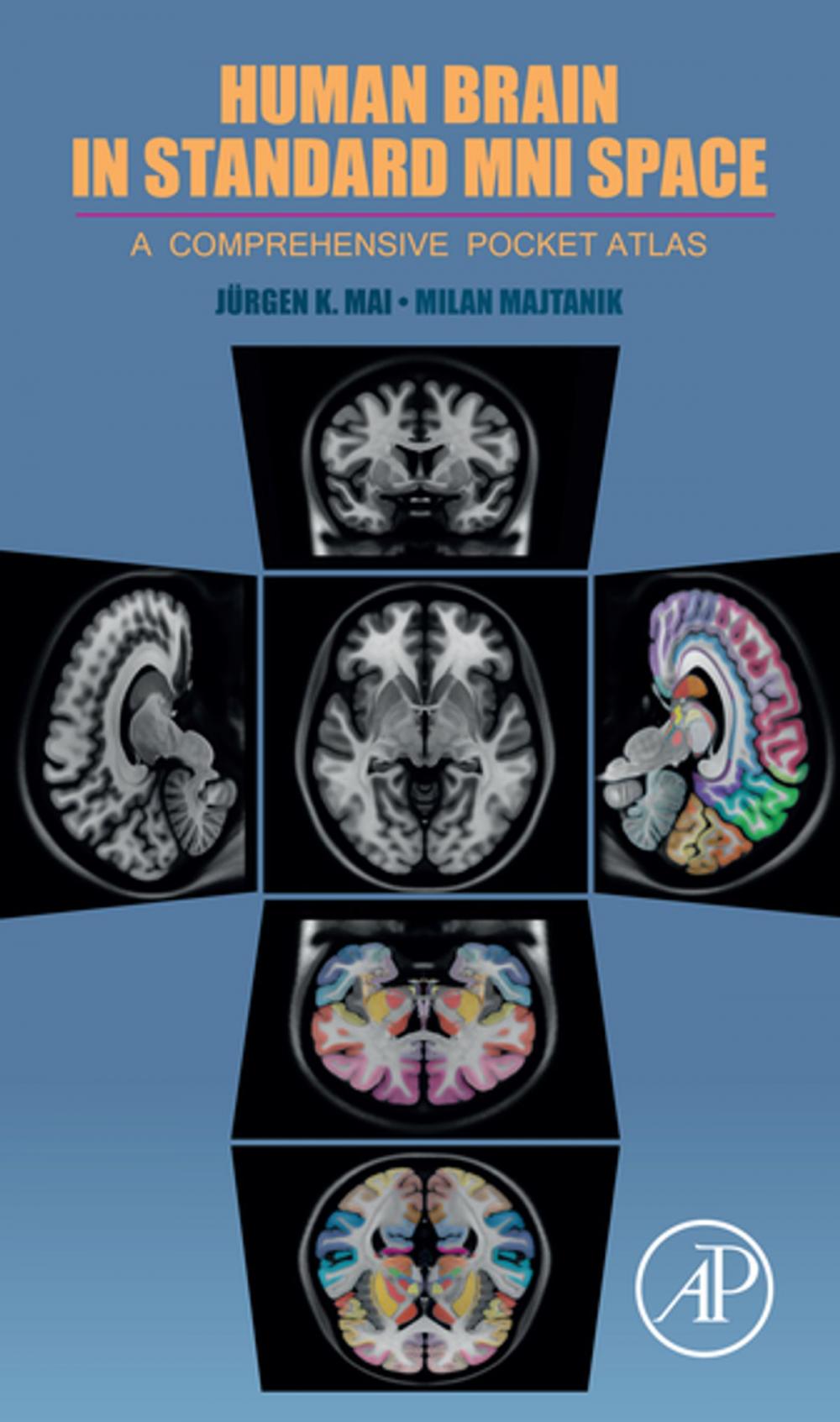 Big bigCover of Human Brain in Standard MNI Space