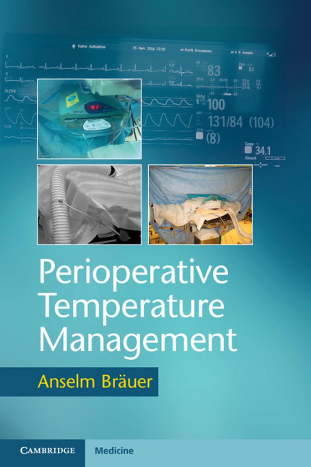 Big bigCover of Perioperative Temperature Management