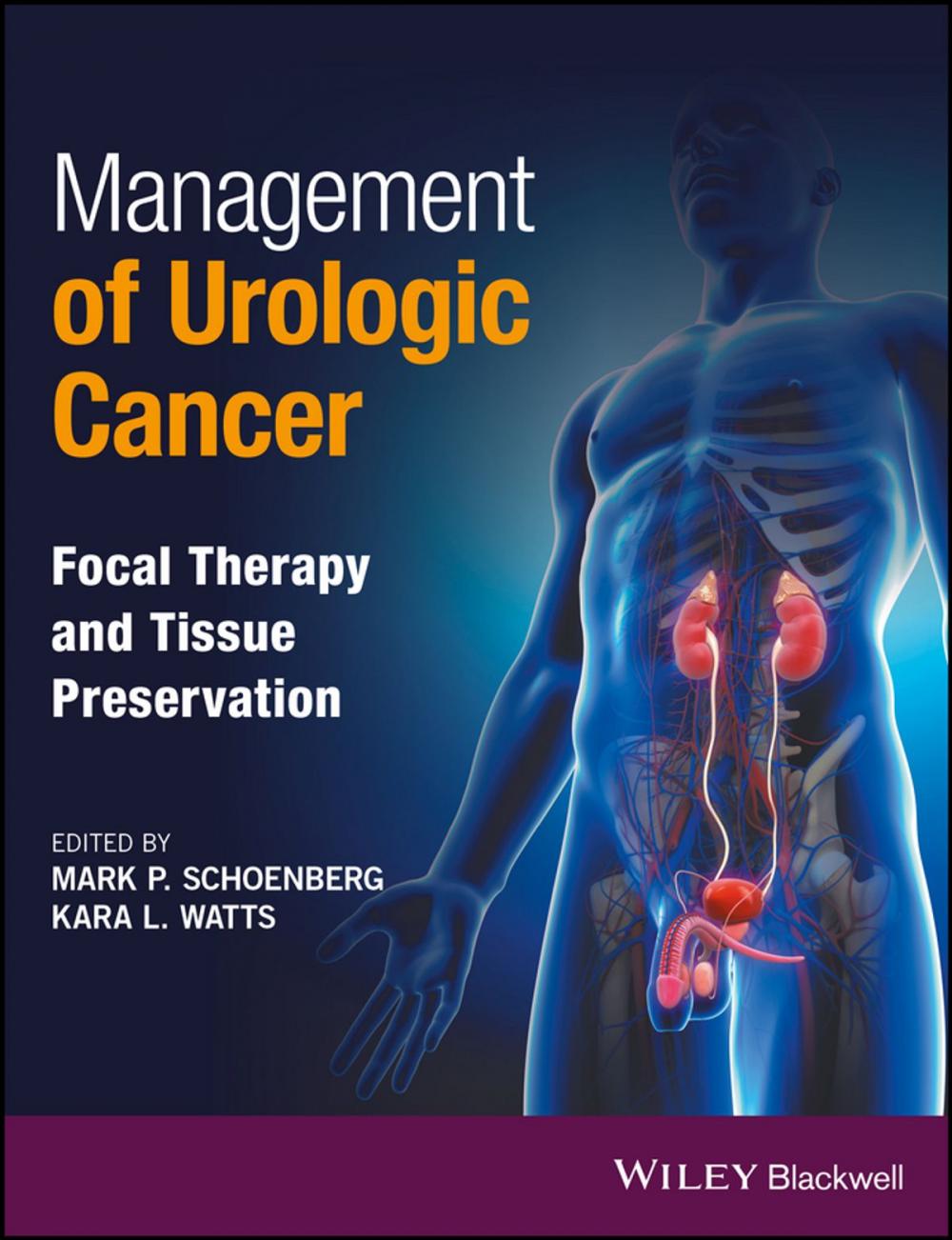 Big bigCover of Management of Urologic Cancer