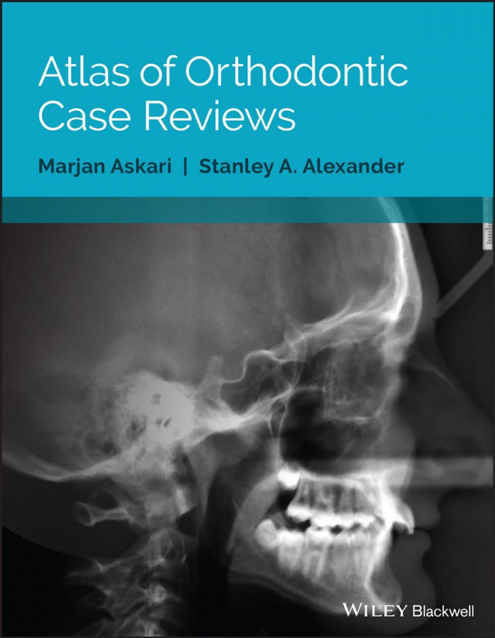 Big bigCover of Atlas of Orthodontic Case Reviews