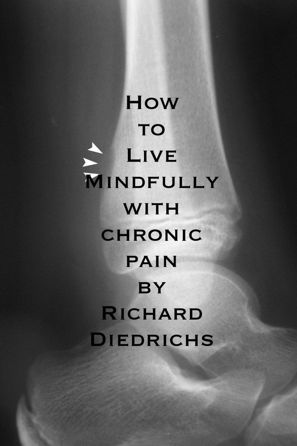 Big bigCover of How to Live Mindfully with Chronic Pain