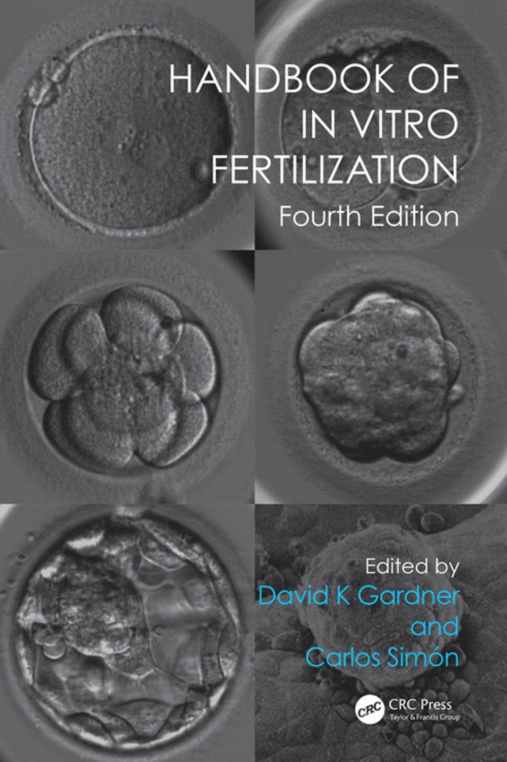 Big bigCover of Handbook of In Vitro Fertilization