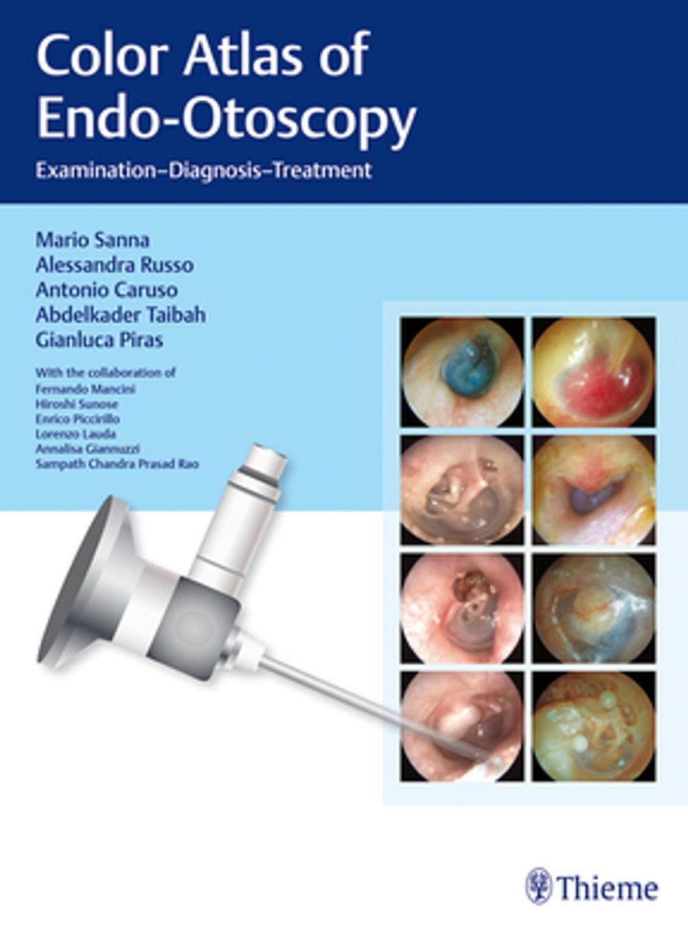 Big bigCover of Color Atlas of Endo-Otoscopy