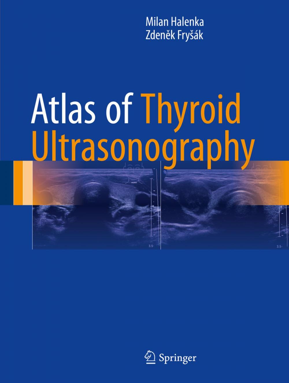 Big bigCover of Atlas of Thyroid Ultrasonography