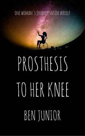 Cover of the book Prosthesis To Her Knee by Charles Dougherty
