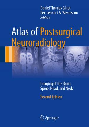 Cover of the book Atlas of Postsurgical Neuroradiology by Larissa Titarenko, Elena Zdravomyslova