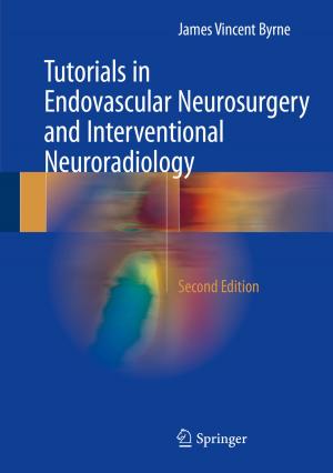 Cover of the book Tutorials in Endovascular Neurosurgery and Interventional Neuroradiology by Stuart Raby