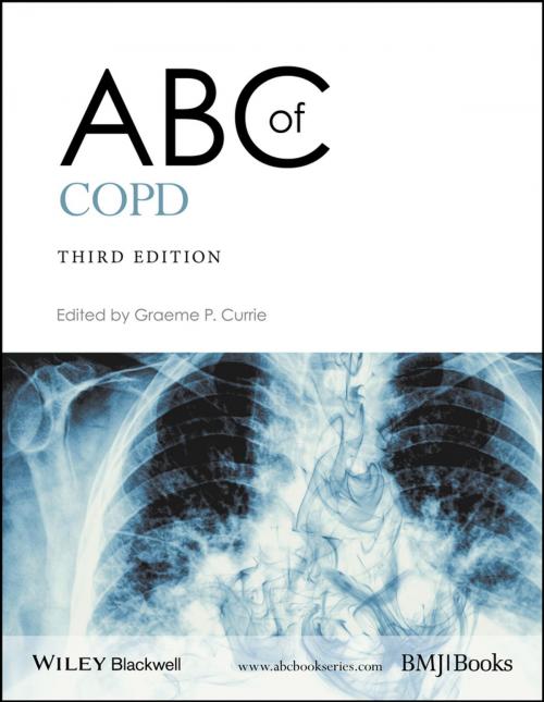 Cover of the book ABC of COPD by , Wiley