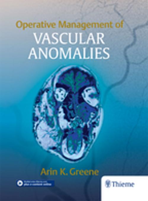 Cover of the book Operative Management of Vascular Anomalies by , Thieme