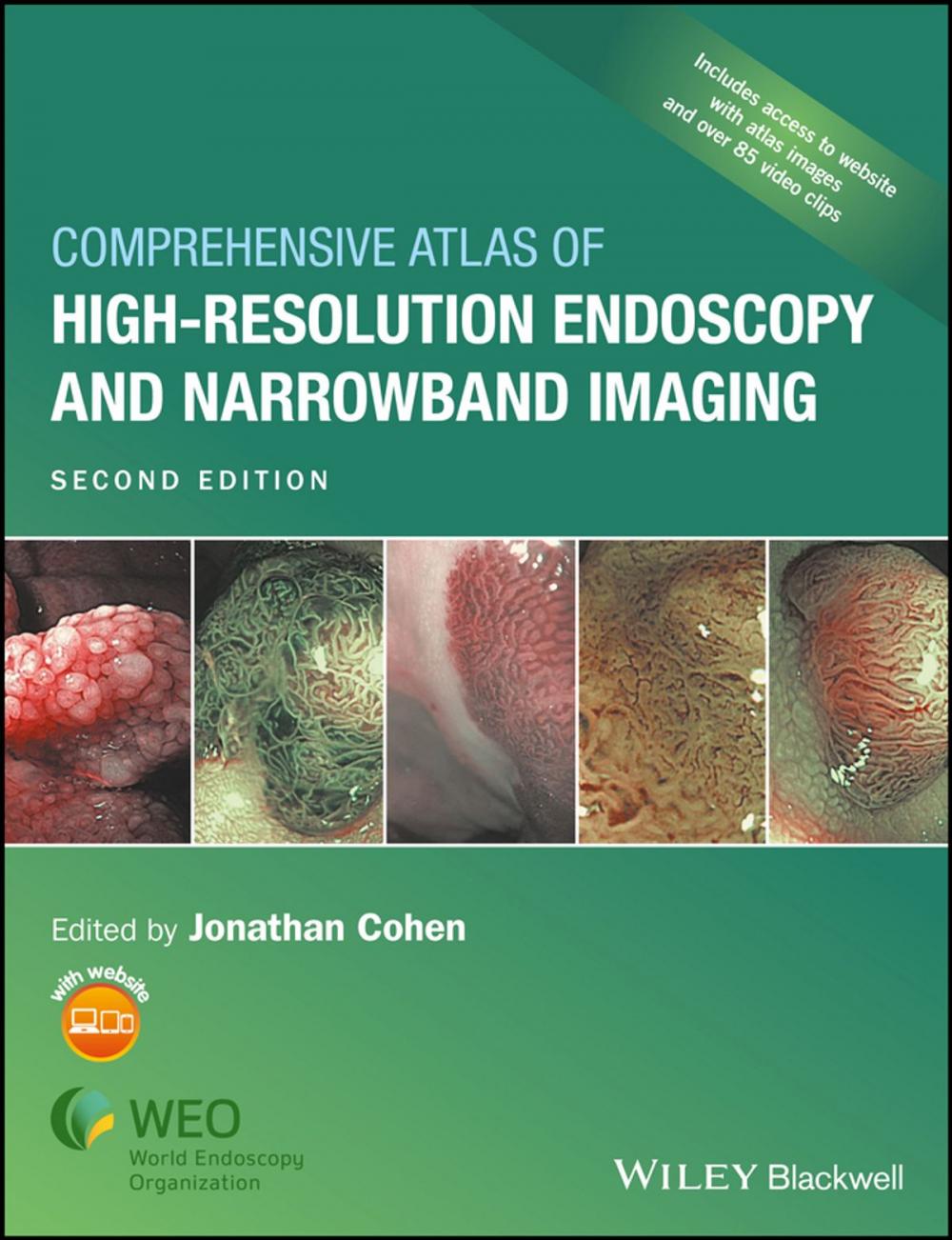 Big bigCover of Comprehensive Atlas of High-Resolution Endoscopy and Narrowband Imaging