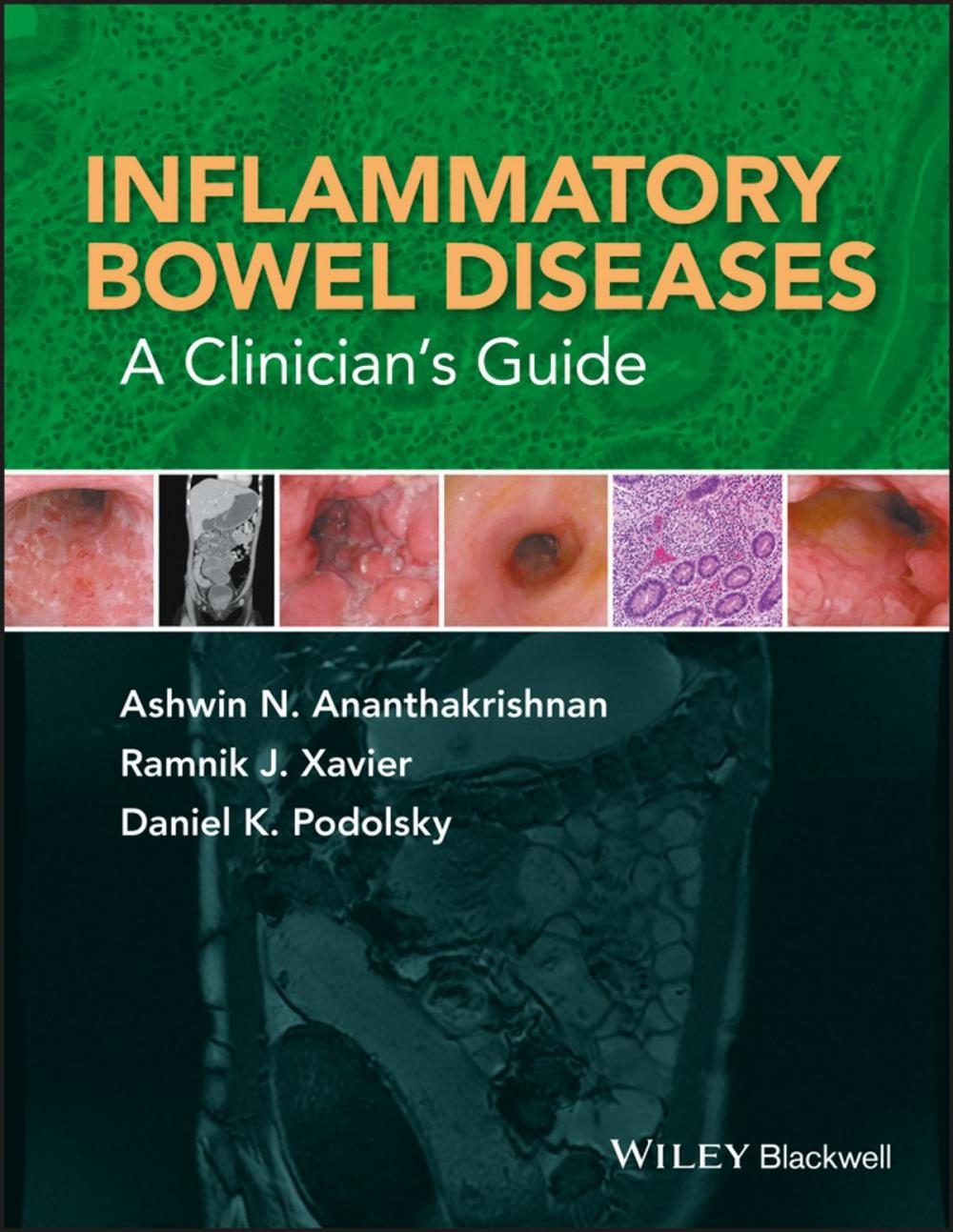 Big bigCover of Inflammatory Bowel Diseases