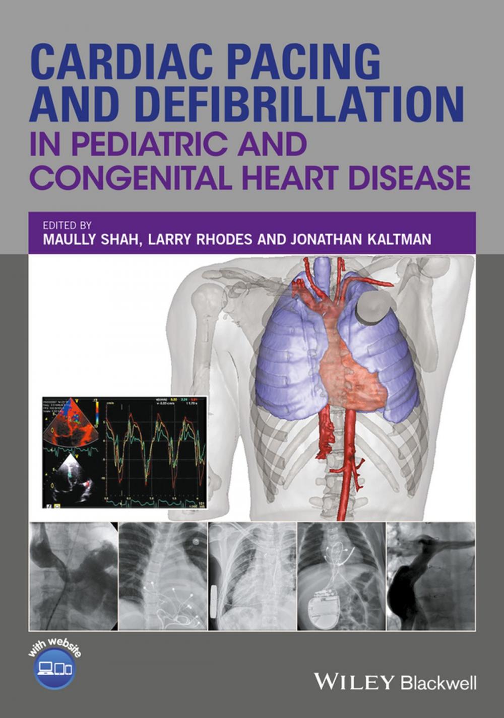 Big bigCover of Cardiac Pacing and Defibrillation in Pediatric and Congenital Heart Disease