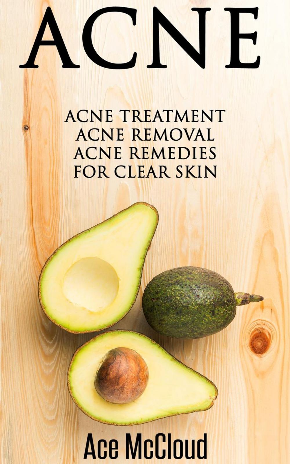 Big bigCover of Acne: Acne Treatment: Acne Removal: Acne Remedies For Clear Skin