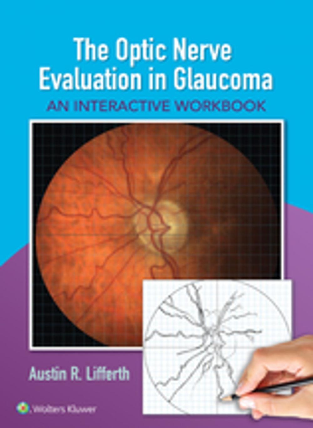 Big bigCover of The Optic Nerve Evaluation in Glaucoma