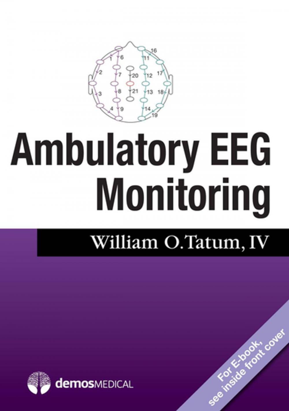 Big bigCover of Ambulatory EEG