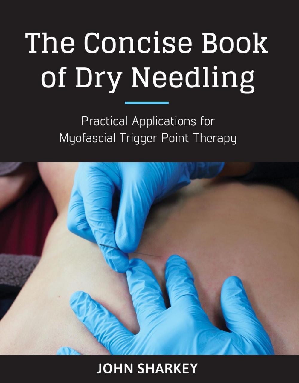 Big bigCover of The Concise Book of Dry Needling