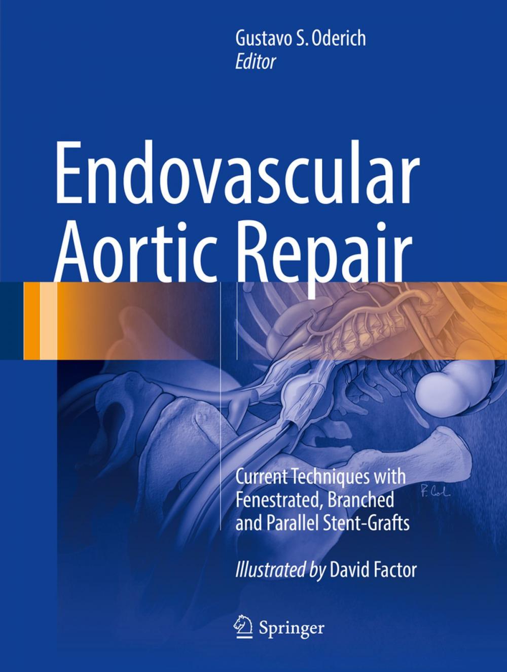 Big bigCover of Endovascular Aortic Repair