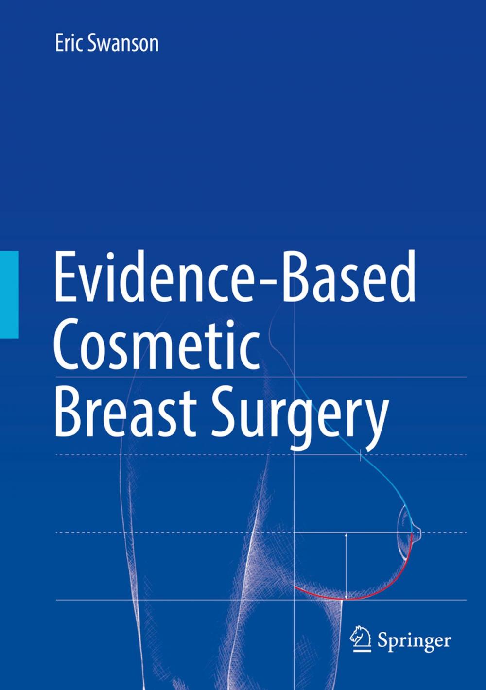 Big bigCover of Evidence-Based Cosmetic Breast Surgery