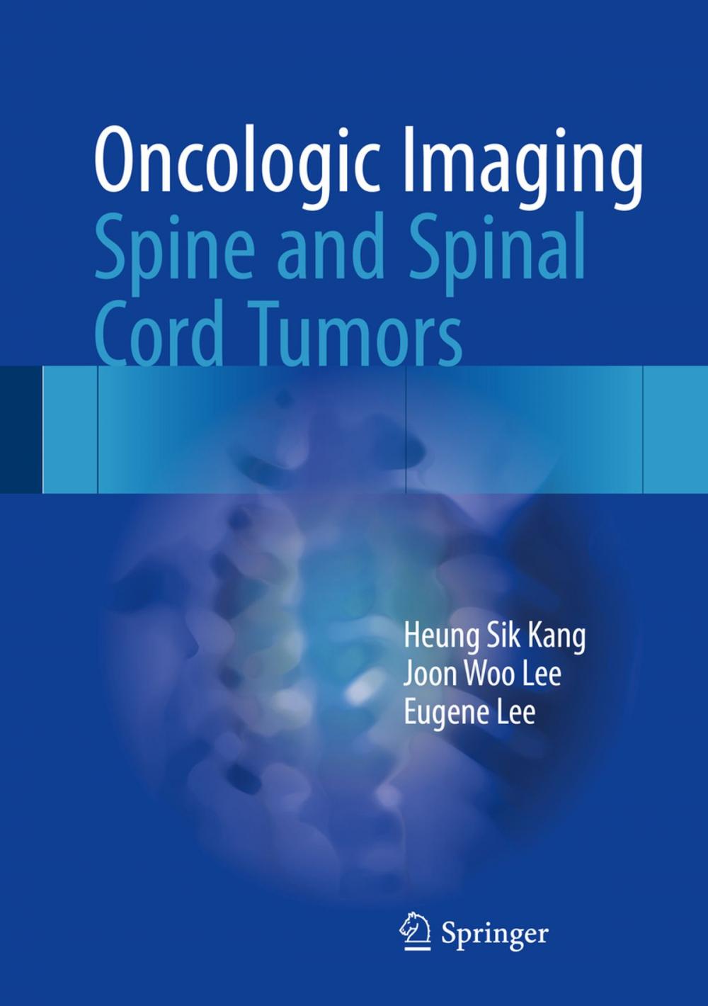 Big bigCover of Oncologic Imaging: Spine and Spinal Cord Tumors