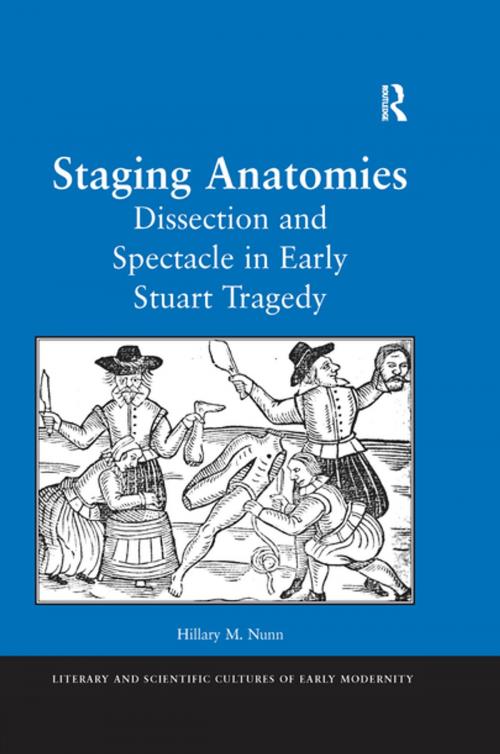 Cover of the book Staging Anatomies by Hillary M. Nunn, Taylor and Francis