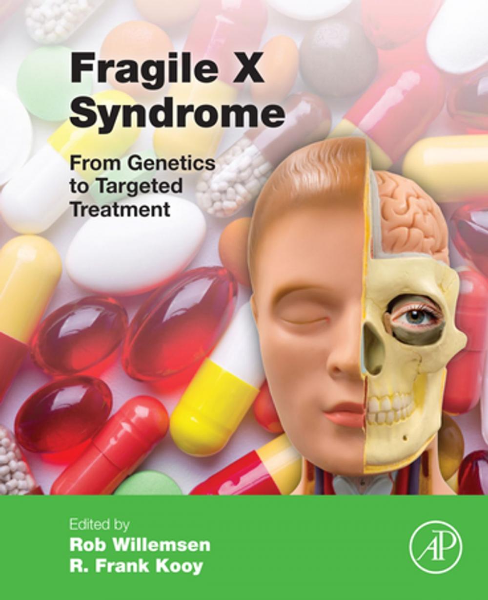 Big bigCover of Fragile X Syndrome