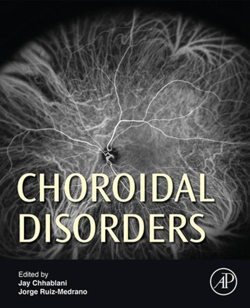 Big bigCover of Choroidal Disorders