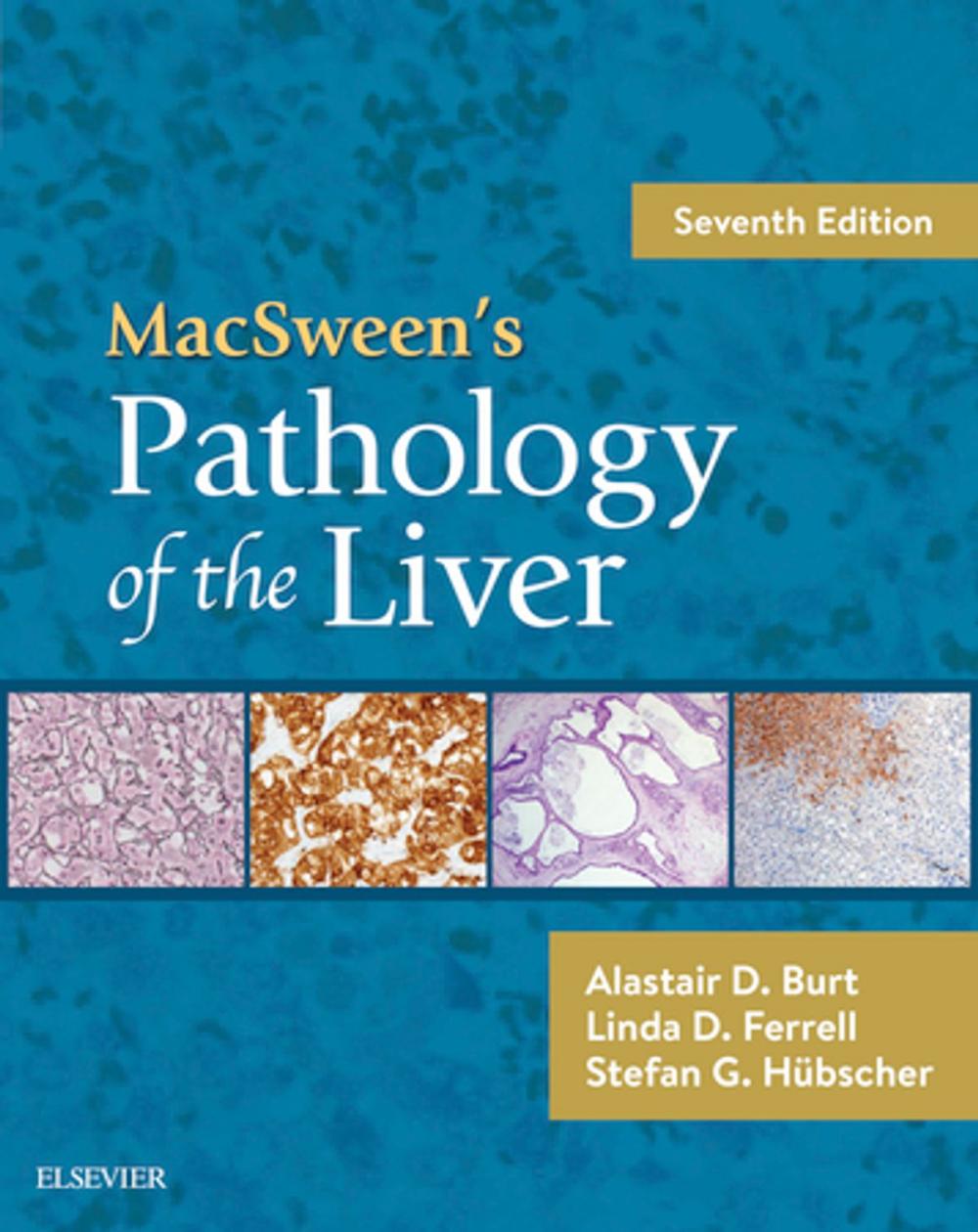 Big bigCover of MacSween's Pathology of the Liver E-Book