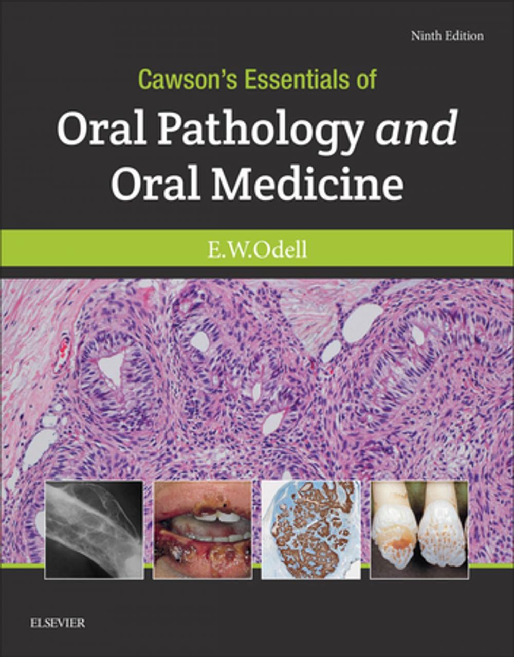 Big bigCover of Cawson's Essentials of Oral Pathology and Oral Medicine E-Book