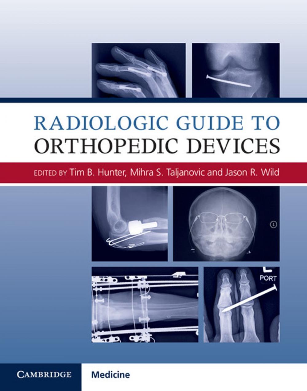 Big bigCover of Radiologic Guide to Orthopedic Devices