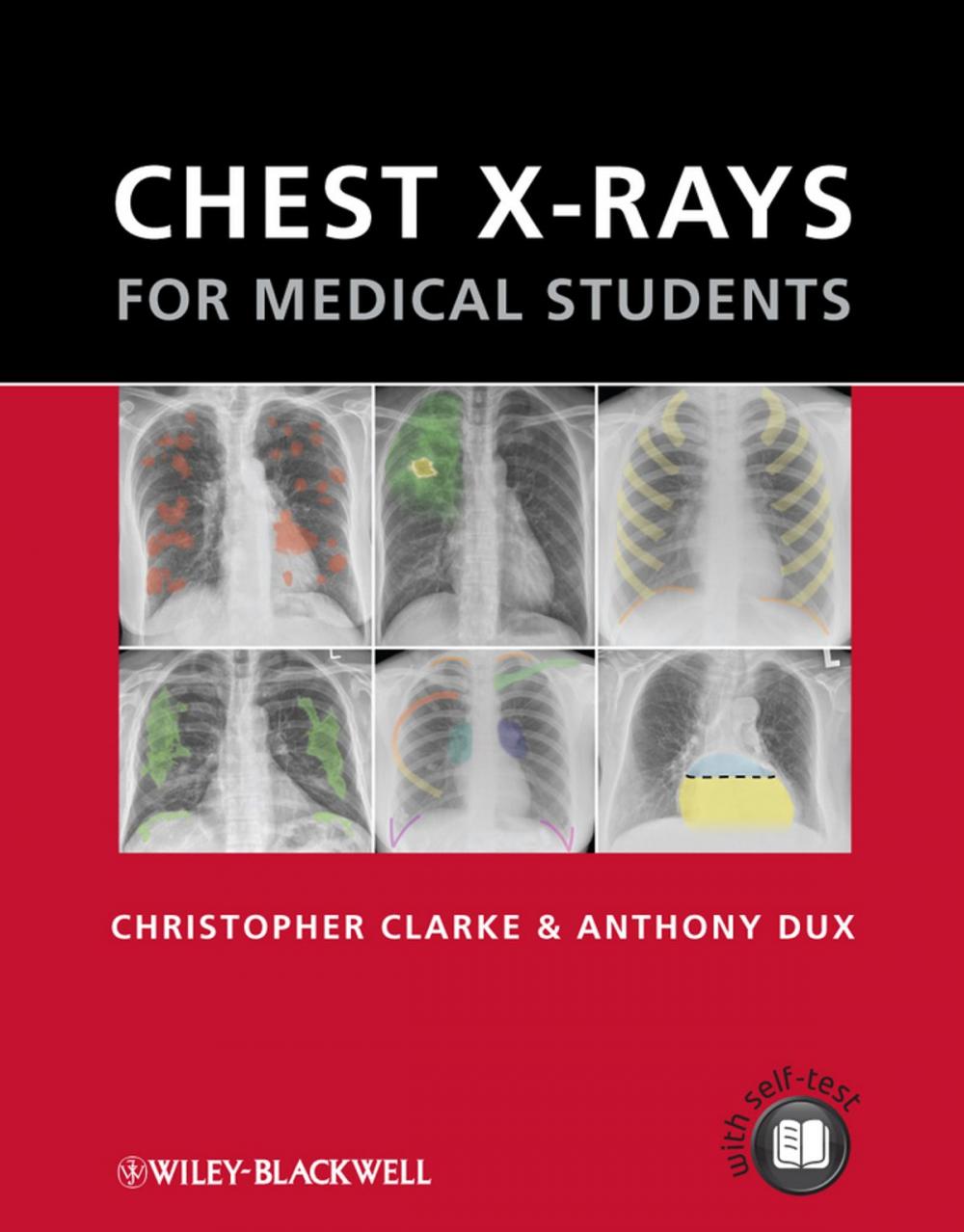 Big bigCover of Chest X-rays for Medical Students