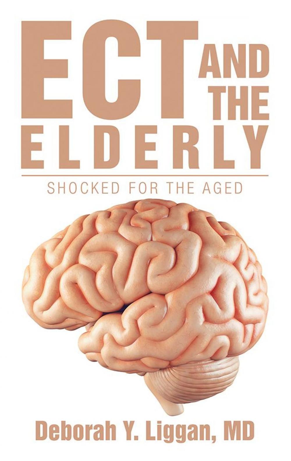 Big bigCover of Ect and the Elderly: Shocked for the Aged