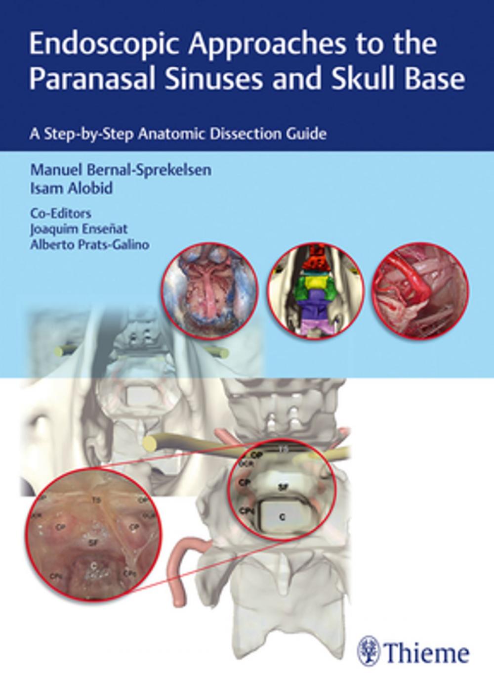 Big bigCover of Endoscopic Approaches to the Paranasal Sinuses and Skull Base