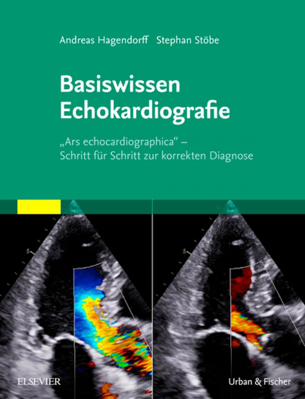 Big bigCover of Basiswissen Echokardiografie