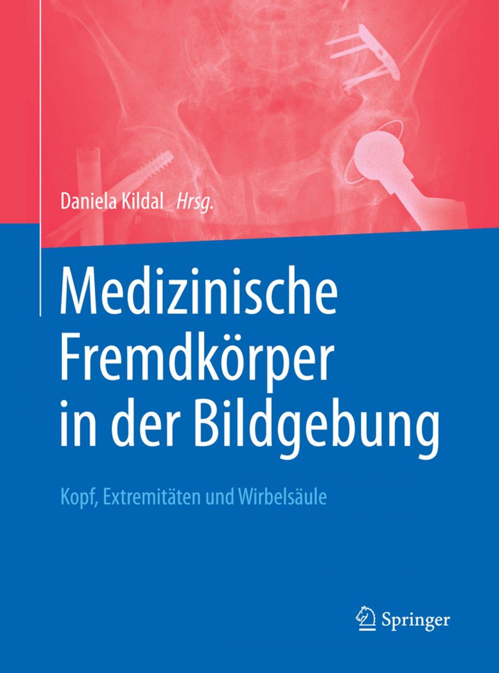 Big bigCover of Medizinische Fremdkörper in der Bildgebung