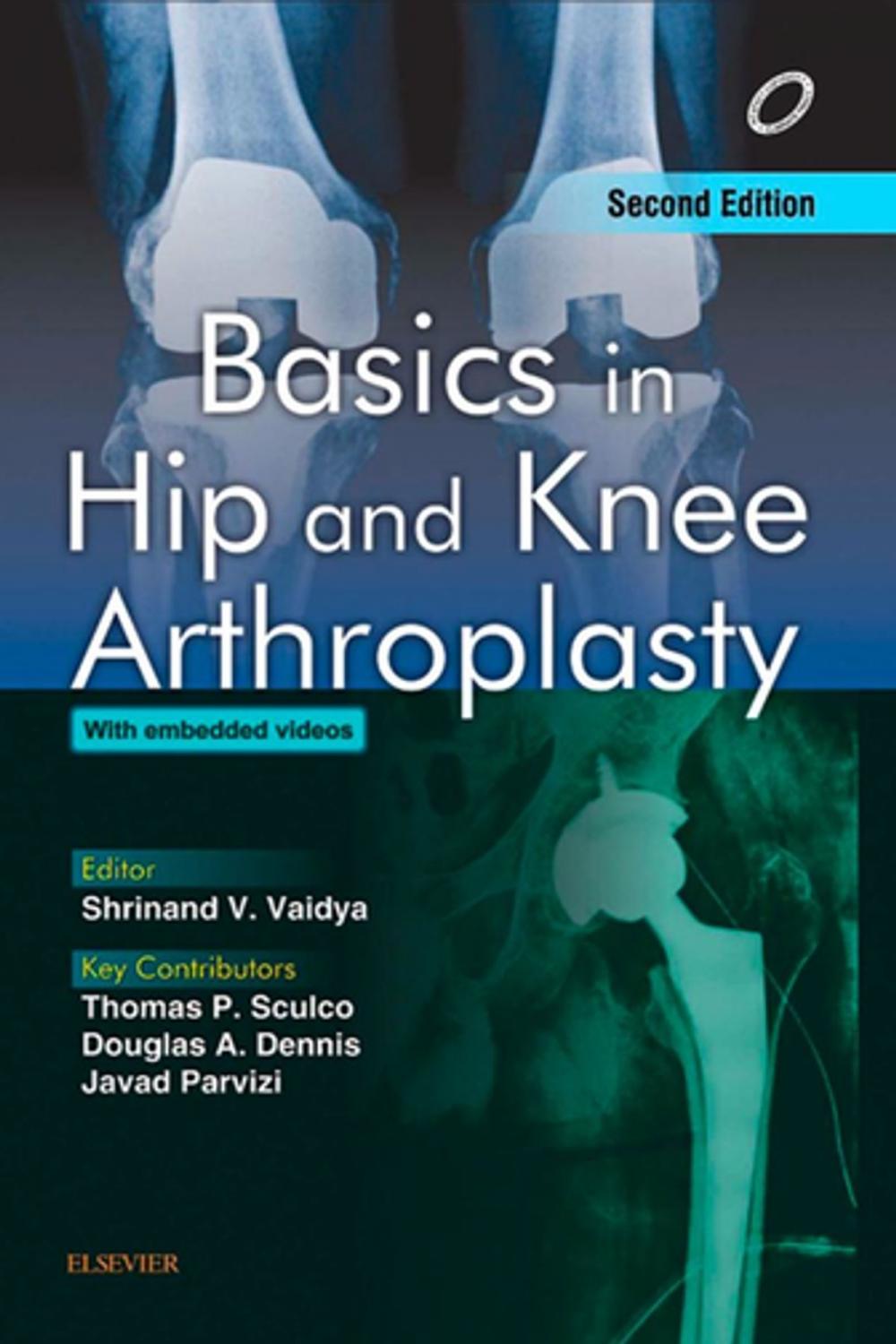 Big bigCover of Basics in Hip and Knee Arthroplasty - E-book