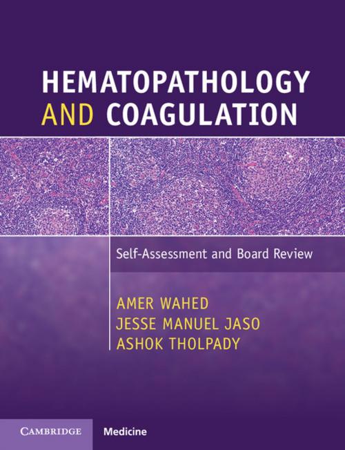 Cover of the book Hematopathology and Coagulation by Amer Wahed, Jesse Manuel Jaso, Ashok Tholpady, Cambridge University Press