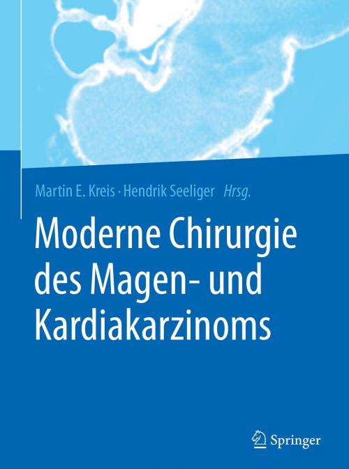 Cover of the book Moderne Chirurgie des Magen- und Kardiakarzinoms by , Springer Berlin Heidelberg