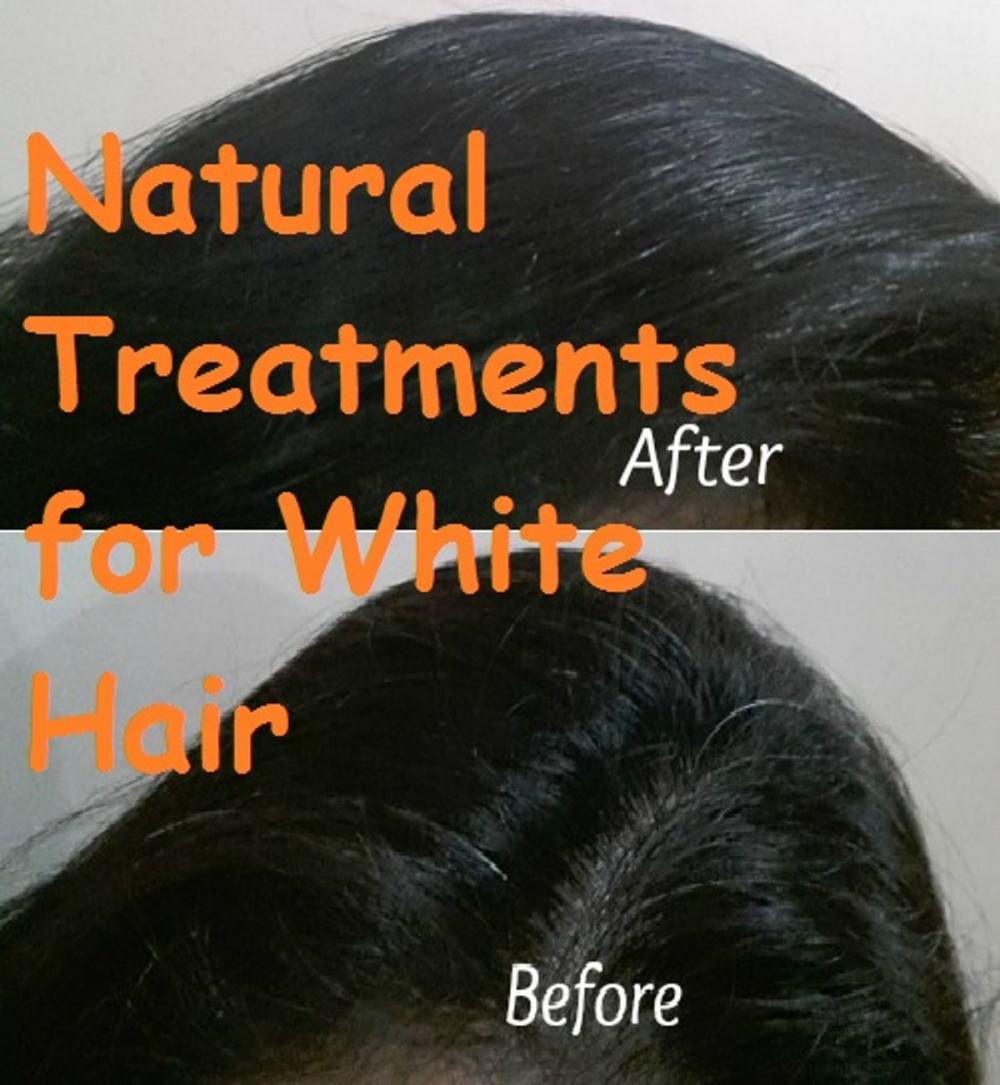 Big bigCover of Natural Treatments for White Hair