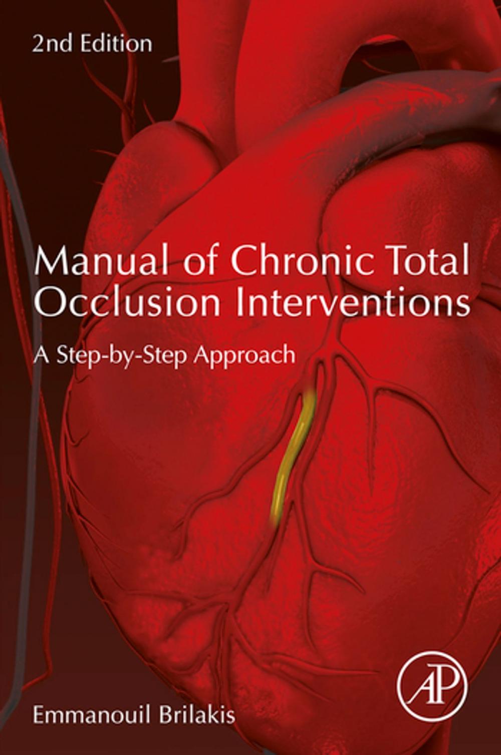 Big bigCover of Manual of Chronic Total Occlusion Interventions