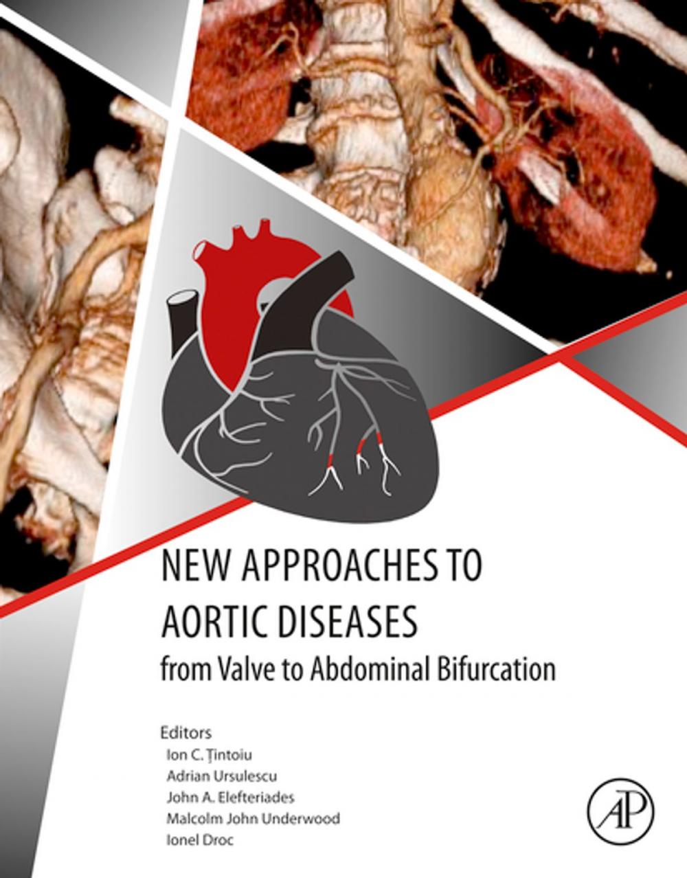 Big bigCover of New Approaches to Aortic Diseases from Valve to Abdominal Bifurcation