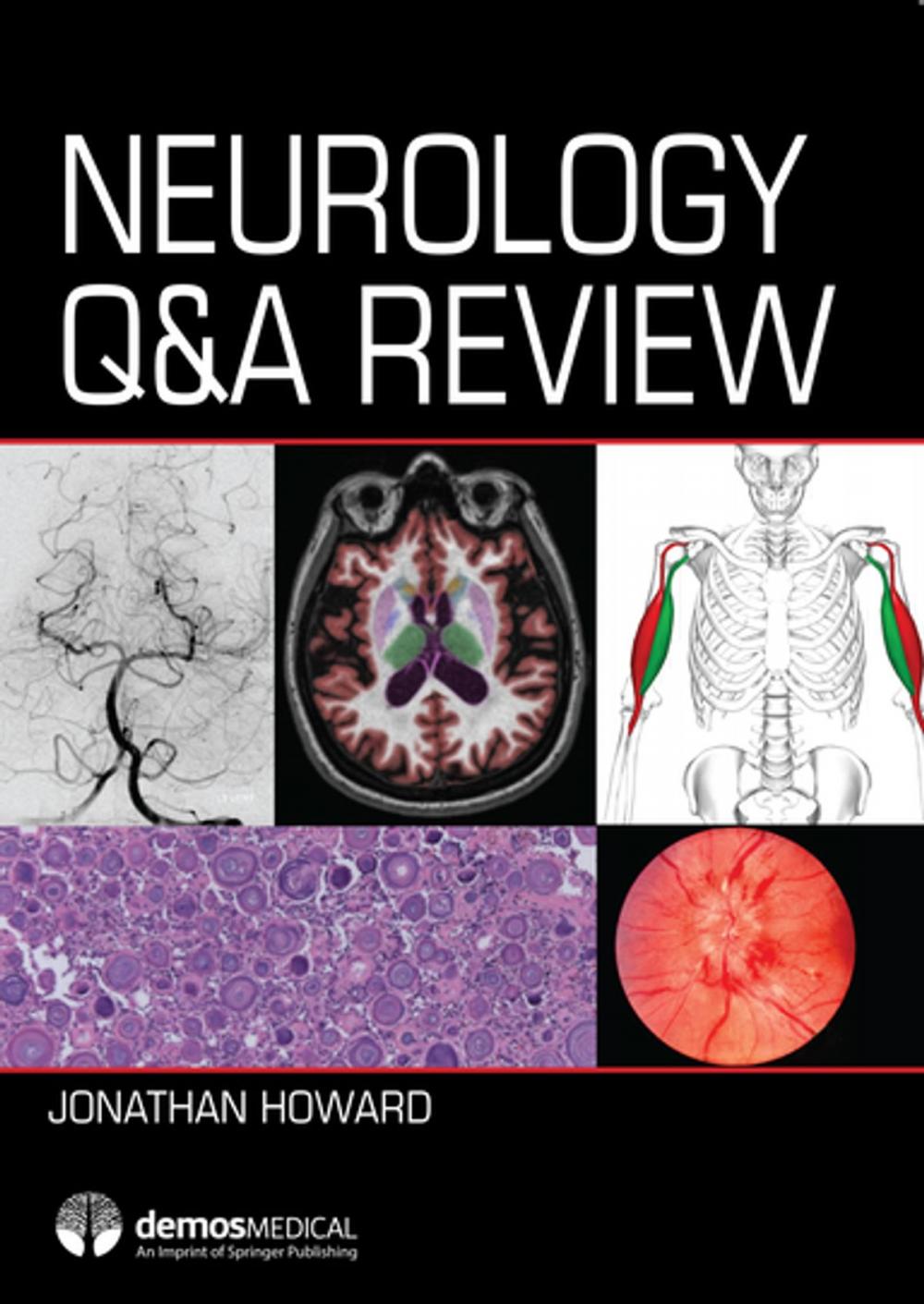 Big bigCover of Neurology Q&A Review