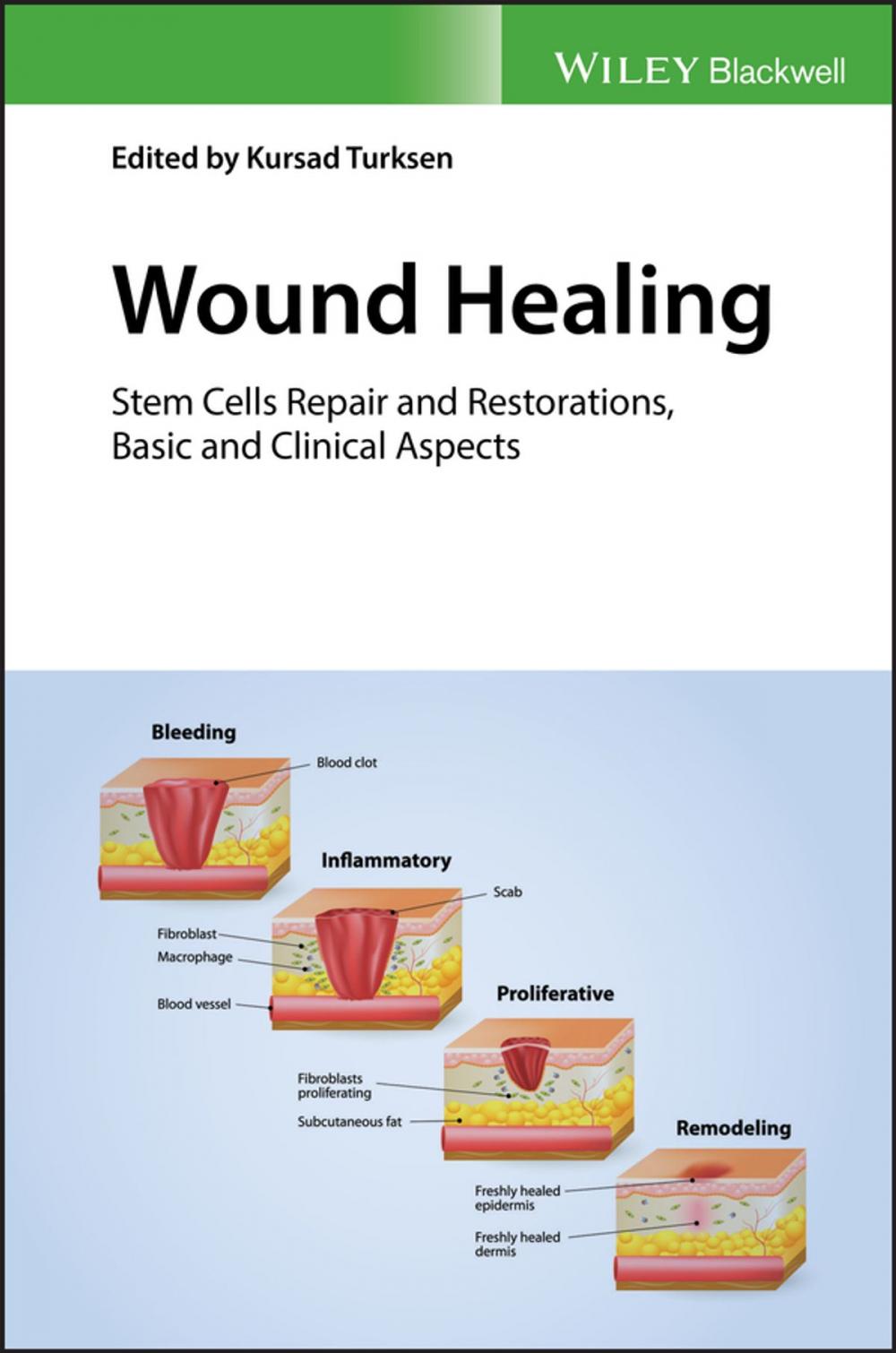 Big bigCover of Wound Healing